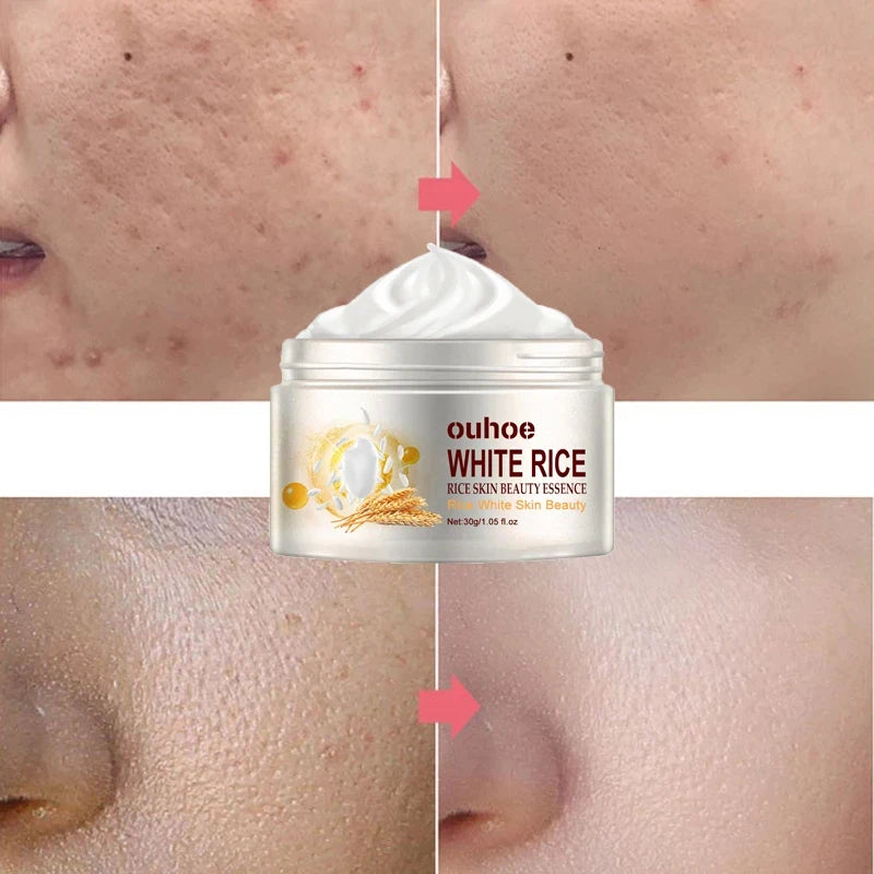 Rice Anti-wrinkle Facial Cream Acne Melasma Treatment Pigmentation Whitening Face Lifting Beauty Moisturizer Korean Cosmetics30g - Maria